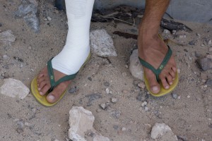 Antony Ruenes foot injury - Pic: Continentseven/Kerstin Reiger